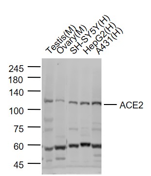 Lane 1: Mouse Testis lysates; Lane 2:Mouse Ovary lysates; Lane 3: SH-SY5Y cell lysates; Lane 4: HepG2 cell lysates; Lane 5: A431 cell lysates probed with ACE2 Polyclonal Antibody, Unconjugated (bs-23444R) at 1:1000 dilution and 4˚C overnight incubation. Followed by conjugated secondary antibody incubation at 1:20000 for 60 min at 37˚C.