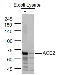 Lane 1:Human ACE2 Protein Overexpression E.coli Lysates; Lane 2: Control group E.coli Lysates probed with ACE2 Polyclonal Antibody, Unconjugated (bs-23444R) at 1:1000 dilution and 4˚C overnight incubation. Followed by conjugated secondary antibody incubation at 1:20000 for 60 min at 37˚C.