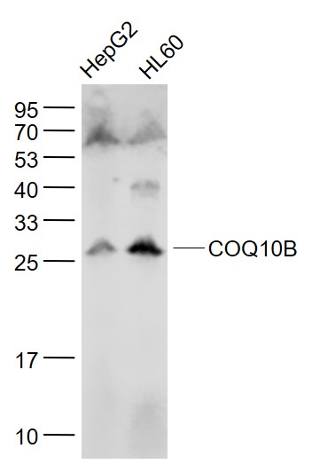 Lane 1: HepG2 cell lysates; Lane 2: HL60 cell lysates probed with COQ10B Polyclonal Antibody, Unconjugated (bs-11656R) at 1:1000 dilution and 4˚C overnight incubation. Followed by conjugated secondary antibody incubation at 1:20000 for 60 min at 37˚C.