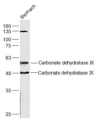 Lane 1: Rat Stomach lysates probed with Carbonic Anhydrase 9 Polyclonal Antibody, Unconjugated (bs-4029R) at 1:1000 dilution and 4˚C overnight incubation. Followed by conjugated secondary antibody incubation at 1:20000 for 60 min at 37˚C.