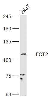 Lane 1: 293T cell lysates probed with ECT2 Polyclonal Antibody, Unconjugated (bs-4102R) at 1:1000 dilution and 4˚C overnight incubation. Followed by conjugated secondary antibody incubation at 1:20000 for 60 min at 37˚C.