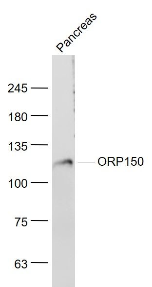Lane 1: Mouse Pancreas cell lysates probed with ORP150 Polyclonal Antibody, Unconjugated (bs-4248R) at 1:1000 dilution and 4˚C overnight incubation. Followed by conjugated secondary antibody incubation at 1:20000 for 60 min at 37˚C.