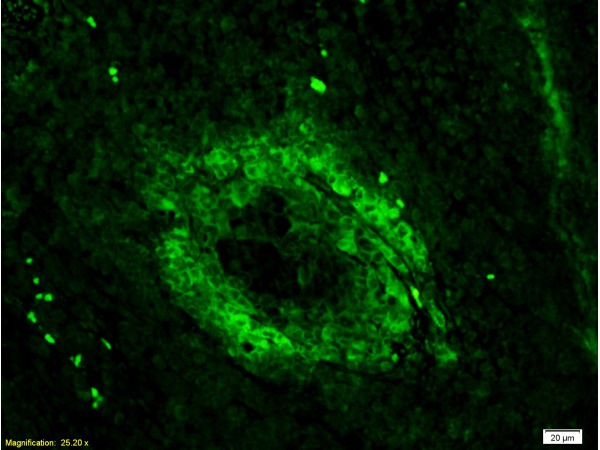 Formalin-fixed and paraffin embedded mouse lymphoma tissue labeled Anti-CD3 Polyclonal Antibody, Unconjugated (bs-0765R) 1:200, followed by conjugation to the secondary antibody Goat Anti-Rabbit IgG, FITC conjugated(bs-0295G-FITC)used at 1:200 dilution for 40 minutes at 37°C.