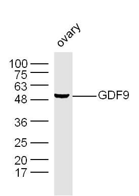 Lane 1: Mouse Ovary cell lysates probed with GDF9 Polyclonal Antibody, Unconjugated (bs-4720R) at 1:300 dilution and 4˚C overnight incubation. Followed by conjugated secondary antibody incubation at 1:20000 for 60 min at 37˚C.