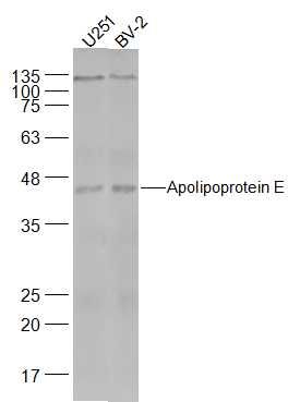 Lane 1: U251 cell lysates; Lane 2: Mouse BV-2 cell lysates probed with Apolipoprotein E Polyclonal Antibody, Unconjugated (bs-4892R) at 1:500 dilution and 4˚C overnight incubation. Followed by conjugated secondary antibody incubation at 1:20000 for 60 min at 37˚C.