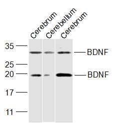Lane 1: Mouse Cerebrum cell lysates probed with BDNF Polyclonal Antibody, Unconjugated (bs-4989R) at 1:300 dilution and 4˚C overnight incubation. Followed by conjugated secondary antibody incubation at 1:20000 for 60 min at 37˚C.