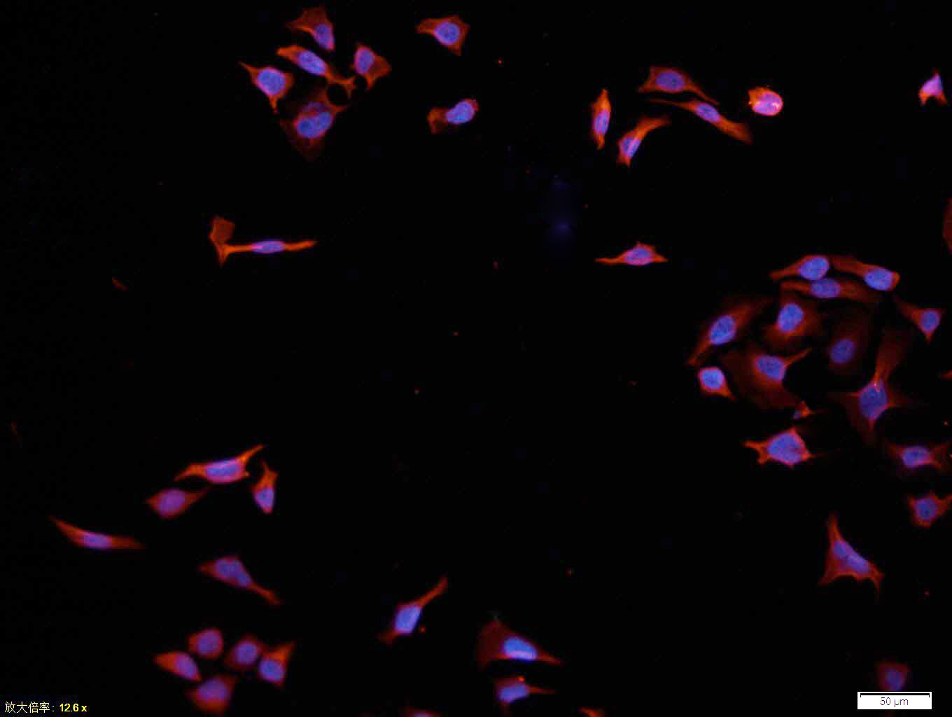 Tissue\/cell: Hela cell; 4% Paraformaldehyde-fixed; Triton X-100 at room temperature for 20 min; Blocking buffer (normal goat serum, C-0005) at 37\u00b0C for 20 min; Antibody incubation with (MAKT1) polyclonal Antibody, Unconjugated (bs-0115M) 1:100, 90 minutes at 37\u00b0C; followed by a conjugated Goat Anti-Mouse IgG-CY3 antibody at 37\u00b0C for 90 minutes, DAPI (blue, C02-04002) was used to stain the cell nuclei.