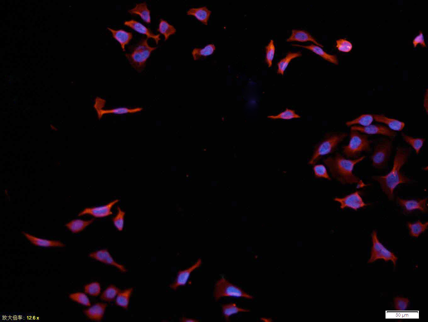 Tissue/cell: Hela cell; 4% Paraformaldehyde-fixed; Triton X-100 at room temperature for 20 min; Blocking buffer (normal goat serum, C-0005) at 37°C for 20 min; Antibody incubation with (MAKT1) polyclonal Antibody, Unconjugated (bs-0115M) 1:100, 90 minutes at 37°C; followed by a conjugated Goat Anti-Mouse IgG-CY3 antibody at 37°C for 90 minutes, DAPI (blue, C02-04002) was used to stain the cell nuclei.