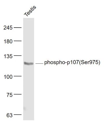 Lane 1: Rat Testis cell lysates probed with p107(Ser975) Polyclonal Antibody, Unconjugated (bs-5696R) at 1:1000 dilution and 4°C overnight incubation. Followed by conjugated secondary antibody incubation at 1:20000 for 60 min at 37°C.