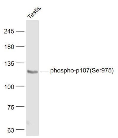 Lane 1: Rat Testis cell lysates probed with p107(Ser975) Polyclonal Antibody, Unconjugated (bs-5696R) at 1:1000 dilution and 4˚C overnight incubation. Followed by conjugated secondary antibody incubation at 1:20000 for 60 min at 37˚C.
