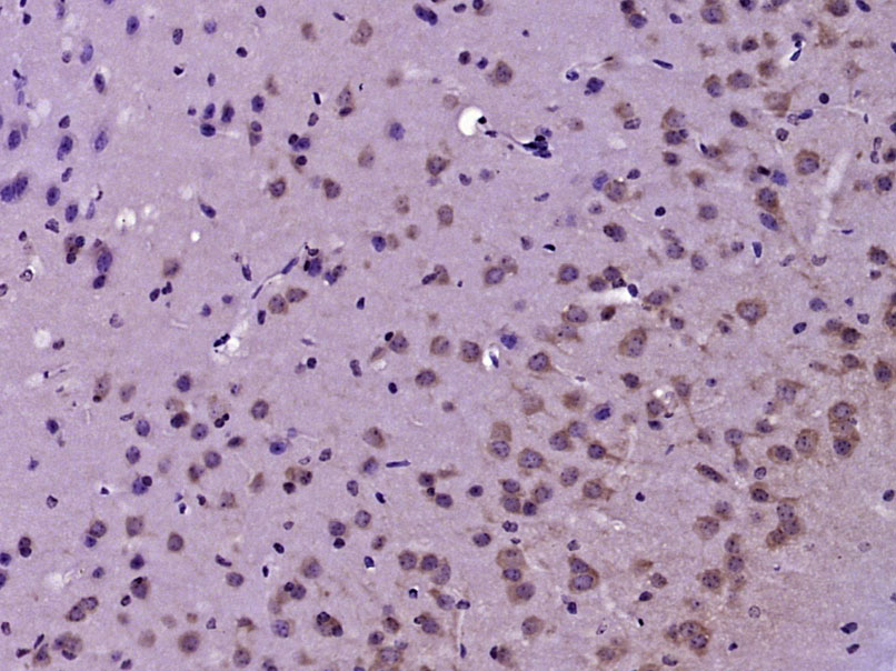 Paraformaldehyde-fixed, paraffin embedded Mouse brain; Antigen retrieval by boiling in sodium citrate buffer (pH6.0) for 15min; Block endogenous peroxidase by 3% hydrogen peroxide for 20 minutes; Blocking buffer (normal goat serum) at 37°C for 30min; Antibody incubation with Tyrosine Hydroxylase Polyclonal Antibody, Unconjugated (bs-0016R) at 1:400 overnight at 4°C, DAB staining.