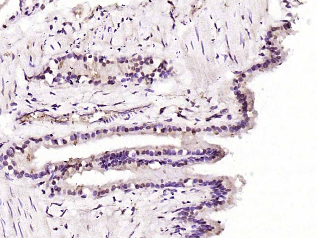 Paraformaldehyde-fixed, paraffin embedded Rat lung; Antigen retrieval by boiling in sodium citrate buffer (pH6.0) for 15min; Block endogenous peroxidase by 3% hydrogen peroxide for 20 minutes; Blocking buffer (normal goat serum) at 37°C for 30min; Antibody incubation with AKT1/3 Polyclonal Antibody, Unconjugated (bs-0115M) at 1:200 overnight at 4°C, DAB staining.