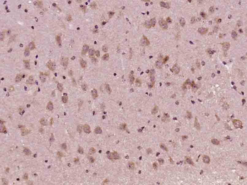 Paraformaldehyde-fixed, paraffin embedded Mouse brain; Antigen retrieval by boiling in sodium citrate buffer (pH6.0) for 15min; Block endogenous peroxidase by 3% hydrogen peroxide for 20 minutes; Blocking buffer (normal goat serum) at 37\u00b0C for 30min; Antibody incubation with AKT1\/3 Polyclonal Antibody, Unconjugated (bs-0115M) at 1:400 overnight at 4\u00b0C, DAB staining.
