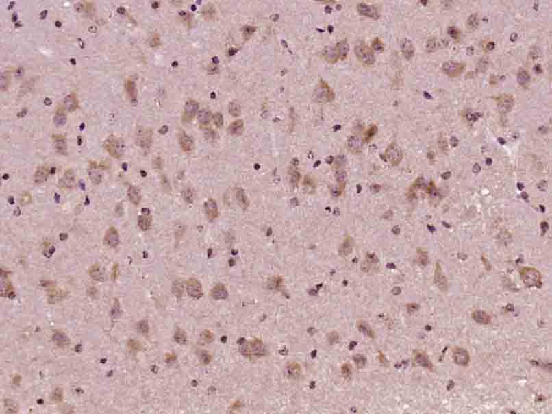 Paraformaldehyde-fixed, paraffin embedded Mouse brain; Antigen retrieval by boiling in sodium citrate buffer (pH6.0) for 15min; Block endogenous peroxidase by 3% hydrogen peroxide for 20 minutes; Blocking buffer (normal goat serum) at 37°C for 30min; Antibody incubation with AKT1/3 Polyclonal Antibody, Unconjugated (bs-0115M) at 1:400 overnight at 4°C, DAB staining.