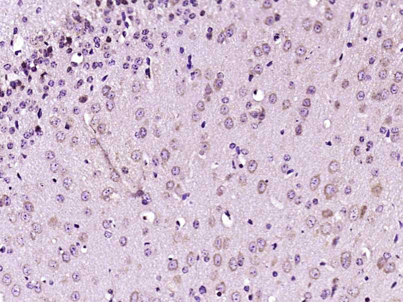 Paraformaldehyde-fixed, paraffin embedded Mouse brain; Antigen retrieval by boiling in sodium citrate buffer (pH6.0) for 15min; Block endogenous peroxidase by 3% hydrogen peroxide for 20 minutes; Blocking buffer (normal goat serum) at 37°C for 30min; Antibody incubation with Neurotrophin 3 Polyclonal Antibody, Unconjugated (bs-0160R) at 1:400 overnight at 4°C, DAB staining.