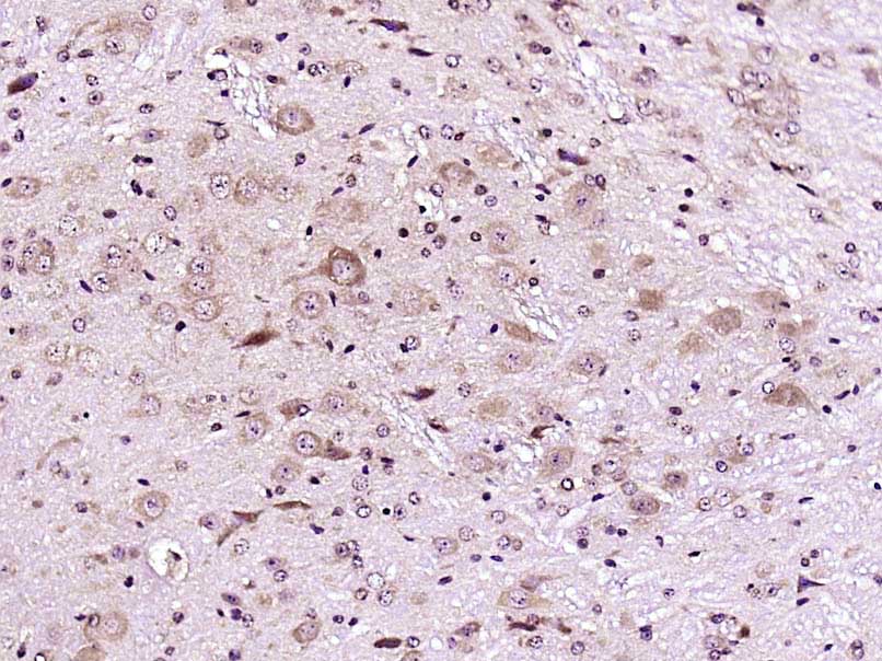 Paraformaldehyde-fixed, paraffin embedded Mouse brain; Antigen retrieval by boiling in sodium citrate buffer (pH6.0) for 15min; Block endogenous peroxidase by 3% hydrogen peroxide for 20 minutes; Blocking buffer (normal goat serum) at 37\u00b0C for 30min; Antibody incubation with DR3 Polyclonal Antibody, Unconjugated (bs-0421R) at 1:400 overnight at 4\u00b0C, DAB staining.