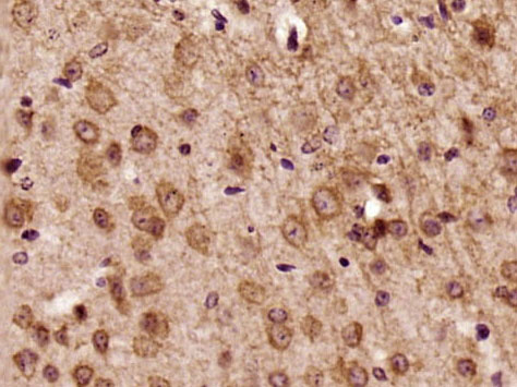 Paraformaldehyde-fixed, paraffin embedded Mouse brain; Antigen retrieval by boiling in sodium citrate buffer (pH6.0) for 15min; Block endogenous peroxidase by 3% hydrogen peroxide for 20 minutes; Blocking buffer (normal goat serum) at 37°C for 30min; Antibody incubation with MOG Polyclonal Antibody, Unconjugated (bs-0426R) at 1:500 overnight at 4°C, DAB staining.