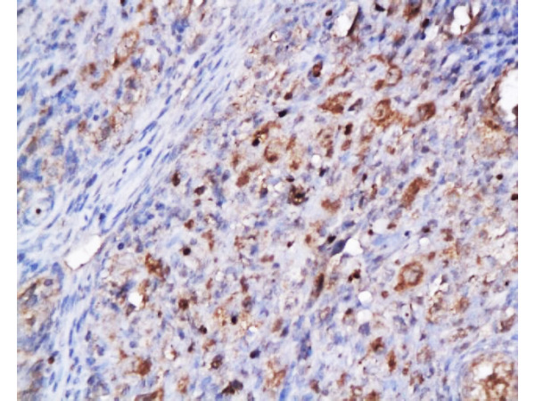 Formalin-fixed and paraffin embedded rat ovary tissue labeled Anti-CDK2 Polyclonal Antibody, Unconjugated (bs-0757R) 1:200, followed by conjugation to the secondary antibody and DAB staining.