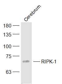 Lane 1: Mouse Cerebrum cell lysates probed with RIPK-1 Polyclonal Antibody, Unconjugated (bs-5805R) at 1:1000 dilution and 4˚C overnight incubation. Followed by conjugated secondary antibody incubation at 1:20000 for 60 min at 37˚C.