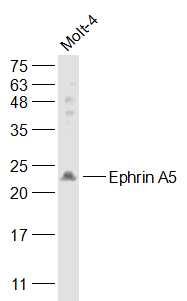 Lane 1: Molt-4 cell lysates probed with Ephrin A5 Polyclonal Antibody, Unconjugated (bs-6048R) at 1:1000 dilution and 4˚C overnight incubation. Followed by conjugated secondary antibody incubation at 1:20000 for 60 min at 37˚C.