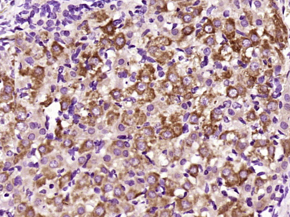 Paraformaldehyde-fixed, paraffin embedded Rat ovarian; Antigen retrieval by boiling in sodium citrate buffer (pH6.0) for 15min; Block endogenous peroxidase by 3% hydrogen peroxide for 20 minutes; Blocking buffer (normal goat serum) at 37°C for 30min; Antibody incubation with FGF8 Polyclonal Antibody, Unconjugated (bs-0735R) at 1:400 overnight at 4°C, DAB staining.