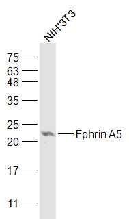 Lane 1: NIH/3T3 cell lysates probed with Ephrin A5 Polyclonal Antibody, Unconjugated (bs-6048R) at 1:1000 dilution and 4˚C overnight incubation. Followed by conjugated secondary antibody incubation at 1:20000 for 60 min at 37˚C.
