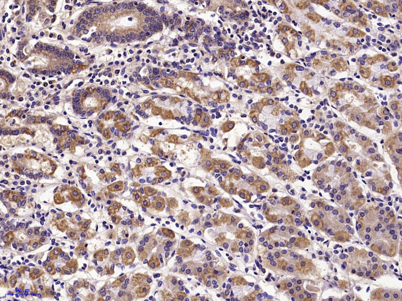 Paraformaldehyde-fixed, paraffin embedded Human stomach; Antigen retrieval by boiling in sodium citrate buffer (pH6.0) for 15min; Block endogenous peroxidase by 3% hydrogen peroxide for 20 minutes; Blocking buffer (normal goat serum) at 37°C for 30min; Antibody incubation with E cadherin Polyclonal Antibody, Unconjugated (bs-10009R) at 1:400 overnight at 4°C, DAB staining.