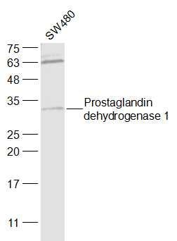 Lane 1:SW480 cell lysates probed with Prostaglandin dehydrogenase 1 Polyclonal Antibody, Unconjugated (bs-6051R) at 1:1000 dilution and 4˚C overnight incubation. Followed by conjugated secondary antibody incubation at 1:20000 for 60 min at 37˚C.