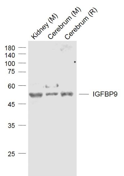 Lane 1: Mouse Kidney cell lysates; Lane 2: Mouse Cerebrum cell lysates; Lane 3: Rat Cerebrum cell lysates probed with IGFBP9 Polyclonal Antibody, Unconjugated (bs-6059R) at 1:1000 dilution and 4˚C overnight incubation. Followed by conjugated secondary antibody incubation at 1:20000 for 60 min at 37˚C. Lane 1: Mouse Kidney cell lysates; Lane 2: Mouse Cerebrum cell lysates; Lane 3: Rat Cerebrum cell lysates probed with IGFBP9 Polyclonal Antibody, Unconjugated (bs-6059R) at 1:1000 dilution and 4˚C overnight incubation. Followed by conjugated secondary antibody incubation at 1:20000 for 60 min at 37˚C.