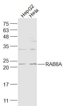 Lane 1: HepG2 cell lysates; Lane 2: Hela cell lysates probed with RAB8A Polyclonal Antibody, Unconjugated (bs-6176R) at 1:1000 dilution and 4˚C overnight incubation. Followed by conjugated secondary antibody incubation at 1:20000 for 60 min at 37˚C.