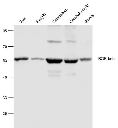 Lane 1: Mouse Eye cell lysates; Lane 2: Rat Eye cell lysates; Lane 3: Mouse Cerebrum cell lysates; Lane 4: Rat Cerebrum cell lysates ; Lane 5: Mouse Uterus cell lysates probed with ROR beta Polyclonal Antibody, Unconjugated (bs-6216R) at 1:1000 dilution and 4˚C overnight incubation. Followed by conjugated secondary antibody incubation at 1:20000 for 60 min at 37˚C.