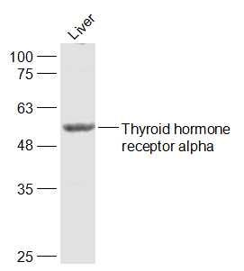 Lane 1: Mouse Liver cell lysates probed with Thyroid Hormone Receptor Polyclonal Antibody, Unconjugated (bs-6221R) at 1:1000 dilution and 4˚C overnight incubation. Followed by conjugated secondary antibody incubation at 1:20000 for 60 min at 37˚C.
