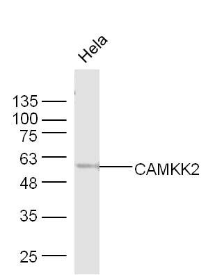 Lane 1: Hela cell lysates probed with CAMKK2 Polyclonal Antibody, Unconjugated (bs-6253R) at 1:300 dilution and 4˚C overnight incubation. Followed by conjugated secondary antibody incubation at 1:20000 for 60 min at 37˚C.