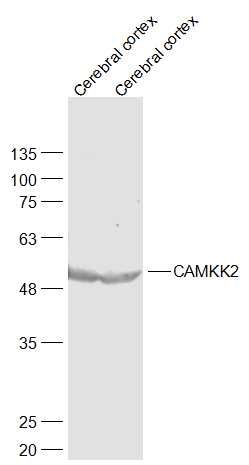 Lane 1: Mouse Cerebral cortex cell lysates; Lane 2: Rat Cerebral cortex cell lysates probed with CAMKK2 Polyclonal Antibody, Unconjugated (bs-6253R) at 1:1000 dilution and 4˚C overnight incubation. Followed by conjugated secondary antibody incubation at 1:20000 for 60 min at 37˚C.