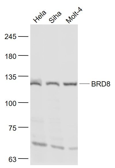Lane 1: Hela cell lysates; Lane 2: Siha cell lysates; Lane 3: Molt-4 cell lysates probed with BRD8 Polyclonal Antibody, Unconjugated (bs-6290R) at 1:1000 dilution and 4˚C overnight incubation. Followed by conjugated secondary antibody incubation at 1:20000 for 60 min at 37˚C.