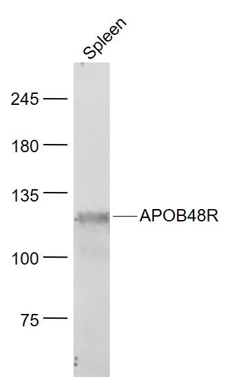 Lane 1: Mouse Spleen lysates probed with APOB48R Polyclonal Antibody, Unconjugated (bs-6336R) at 1:1000 dilution and 4˚C overnight incubation. Followed by conjugated secondary antibody incubation at 1:20000 for 60 min at 37˚C.