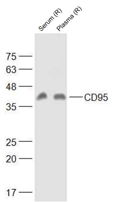 Lane 1: Rat Serum lysates; Lane 2: Rat Plasma lysates probed with Apo-1 Polyclonal Antibody, Unconjugated (bs-6477R) at 1:1000 dilution and 4˚C overnight incubation. Followed by conjugated secondary antibody incubation at 1:20000 for 60 min at 37˚C.