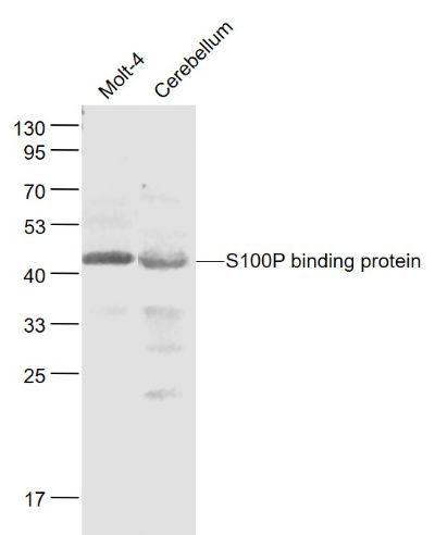 Lane 1: Molt-4 cell lysates; Lane 2: Mouse Cerebellum cell lysates probed with S100P binding protein Polyclonal Antibody, Unconjugated (bs-6577R) at 1:1000 dilution and 4˚C overnight incubation. Followed by conjugated secondary antibody incubation at 1:20000 for 60 min at 37˚C. Lane 1: Molt-4 cell lysates; Lane 2: Mouse Cerebellum cell lysates probed with S100P binding protein Polyclonal Antibody, Unconjugated (bs-6577R) at 1:1000 dilution and 4˚C overnight incubation. Followed by conjugated secondary antibody incubation at 1:20000 for 60 min at 37˚C.