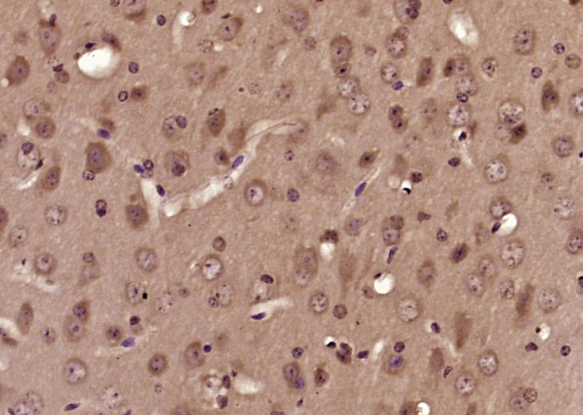 Paraformaldehyde-fixed, paraffin embedded Mouse brain; Antigen retrieval by boiling in sodium citrate buffer (pH6.0) for 15min; Block endogenous peroxidase by 3% hydrogen peroxide for 20 minutes; Blocking buffer (normal goat serum) at 37°C for 30min; Antibody incubation with SOD1 Polyclonal Antibody, Unconjugated (bs-10216R) at 1:200 overnight at 4°C, DAB staining.