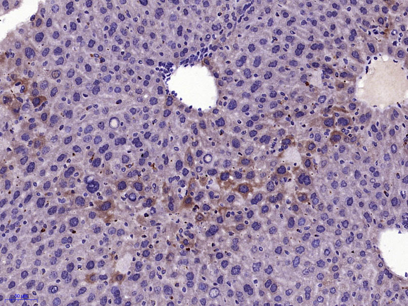 Paraformaldehyde-fixed, paraffin embedded Mouse liver; Antigen retrieval by boiling in sodium citrate buffer (pH6.0) for 15min; Block endogenous peroxidase by 3% hydrogen peroxide for 20 minutes; Blocking buffer (normal goat serum) at 37°C for 30min; Antibody incubation with HGF Polyclonal Antibody, Unconjugated (bs-1025R) at 1:400 overnight at 4°C, DAB staining.