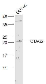 Lane 1: DU145 cell lysates probed with CTAG2 Polyclonal Antibody, Unconjugated (bs-6807R) at 1:300 dilution and 4˚C overnight incubation. Followed by conjugated secondary antibody incubation at 1:20000 for 60 min at 37˚C.