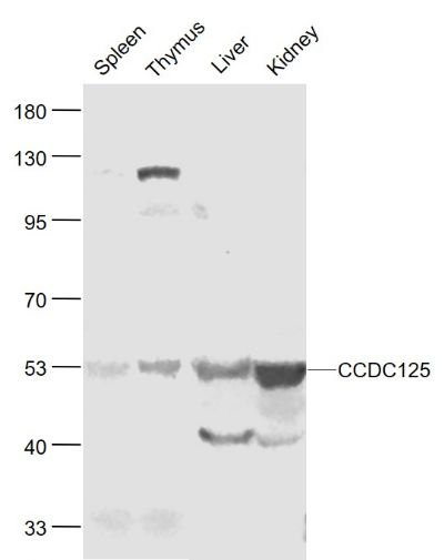 Lane 1: Mouse Spleen cell lysates; Lane 2: MouseThymus cell lysates; Lane 3: Mouse Liver cell lysates; Lane 4: Mouse Kidney cell lysates probed with CCDC125 Polyclonal Antibody, Unconjugated (bs-6926R) at 1:1000 dilution and 4˚C overnight incubation. Followed by conjugated secondary antibody incubation at 1:20000 for 60 min at 37˚C.
