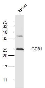 Lane 1: Jurkat cell lysates probed with CD81 Polyclonal Antibody, Unconjugated (bs-6934R) at 1:1000 dilution and 4˚C overnight incubation. Followed by conjugated secondary antibody incubation at 1:20000 for 60 min at 37˚C.