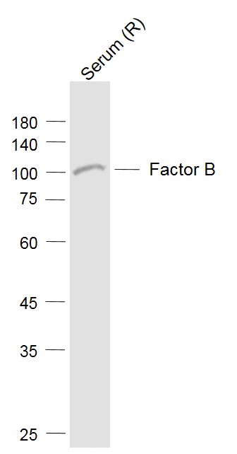 Lane 1: Rat Serum cell lysates probed with Factor B Polyclonal Antibody, Unconjugated (bs-6949R) at 1:1000 dilution and 4˚C overnight incubation. Followed by conjugated secondary antibody incubation at 1:20000 for 60 min at 37˚C.