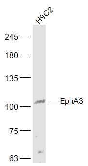 Lane 1: H9C2 cell lysates probed with Eph receptor A3 Polyclonal Antibody, Unconjugated (bs-7032R) at 1:1000 dilution and 4˚C overnight incubation. Followed by conjugated secondary antibody incubation at 1:20000 for 60 min at 37˚C.