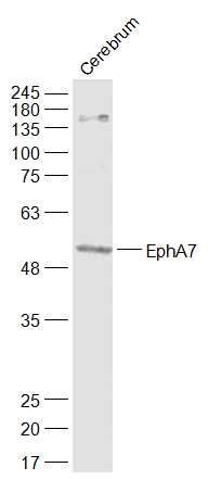 Lane 1: Rat Cerebrum cell lysates probed with Eph receptor A7 Polyclonal Antibody, Unconjugated (bs-7034R) at 1:1000 dilution and 4˚C overnight incubation. Followed by conjugated secondary antibody incubation at 1:20000 for 60 min at 37˚C.