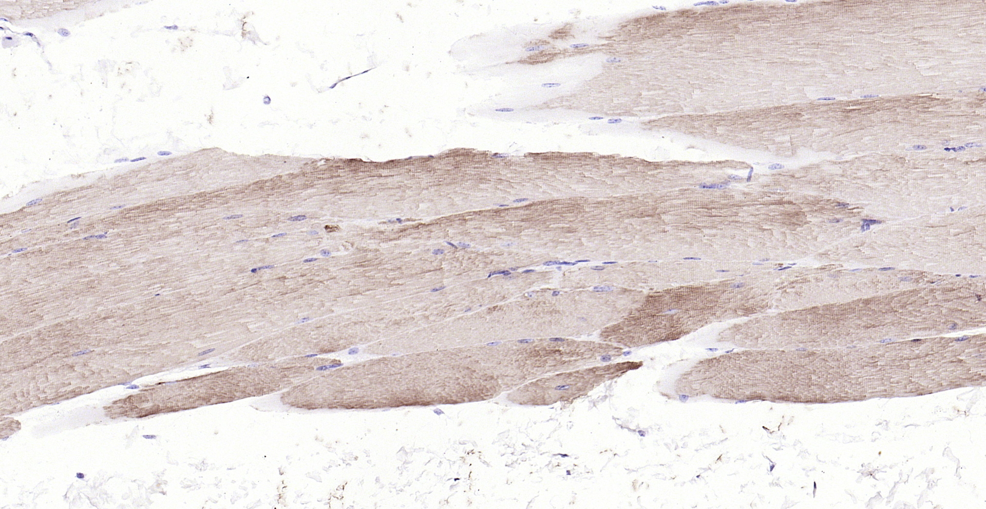 Paraformaldehyde-fixed, paraffin embedded (mouse skeletal muscle); Antigen retrieval by boiling in sodium citrate buffer (pH6.0) for 15min; Block endogenous peroxidase by 3% hydrogen peroxide for 20 minutes; Blocking buffer (normal goat serum) at 37°C for 30min; Antibody incubation with (Actin) Polyclonal Antibody, Unconjugated (bs-10966R) at 1:200 overnight at 4°C, followed by operating according to SP Kit(Rabbit) (sp-0023) instructionsand DAB staining.