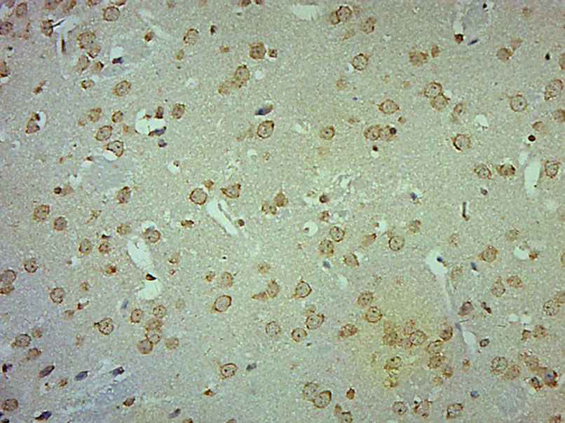 Paraformaldehyde-fixed, paraffin embedded Mouse brain; Antigen retrieval by boiling in sodium citrate buffer (pH6.0) for 15min; Block endogenous peroxidase by 3% hydrogen peroxide for 20 minutes; Blocking buffer (normal goat serum) at 37°C for 30min; Antibody incubation with AADAC Polyclonal Antibody, Unconjugated (bs-11384R) at 1:400 overnight at 4°C, DAB staining.