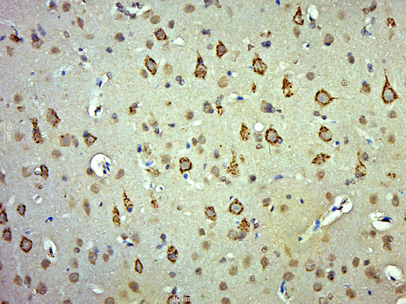 Paraformaldehyde-fixed, paraffin embedded Rat brain; Antigen retrieval by boiling in sodium citrate buffer (pH6.0) for 15min; Block endogenous peroxidase by 3% hydrogen peroxide for 20 minutes; Blocking buffer (normal goat serum) at 37°C for 30min; Antibody incubation with AADAC Polyclonal Antibody, Unconjugated (bs-11384R) at 1:400 overnight at 4°C, DAB staining.