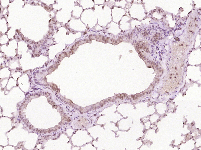 Paraformaldehyde-fixed, paraffin embedded Mouse lung; Antigen retrieval by boiling in sodium citrate buffer (pH6.0) for 15min; Block endogenous peroxidase by 3% hydrogen peroxide for 20 minutes; Blocking buffer (normal goat serum) at 37°C for 30min; Antibody incubation with STAT3 Polyclonal Antibody, Unconjugated (bs-1141R) at 1:400 overnight at 4°C, DAB staining.